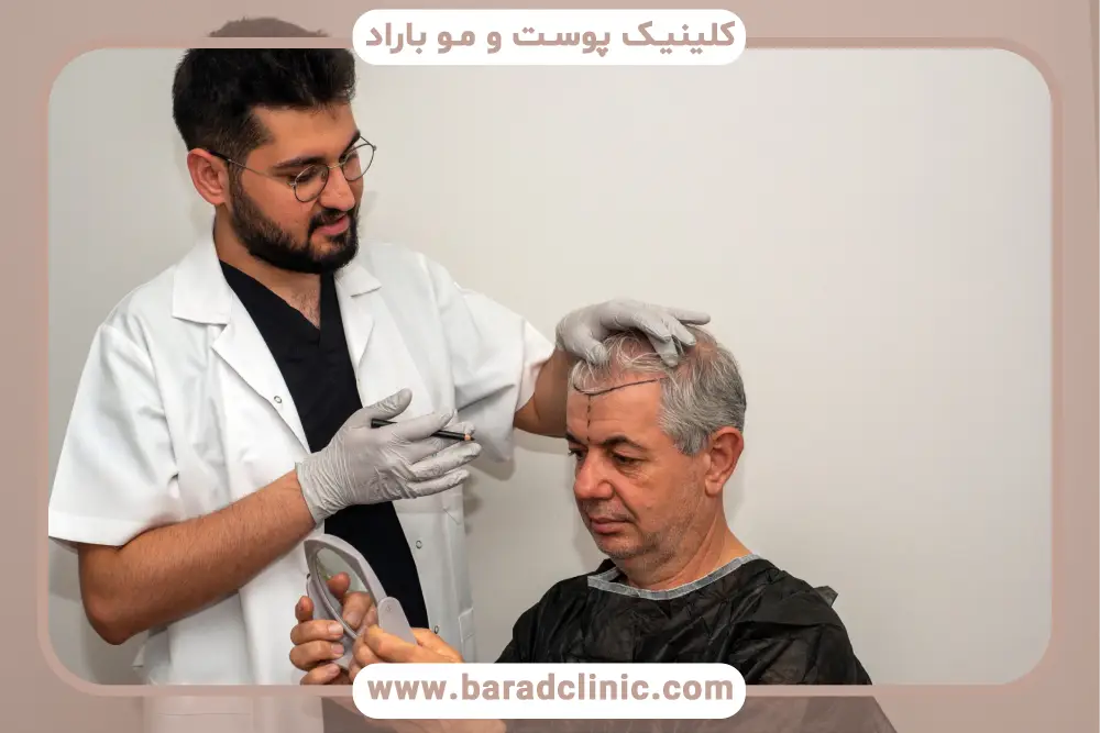 دلیل نیاز به مشاوره رایگان کاشت مو 