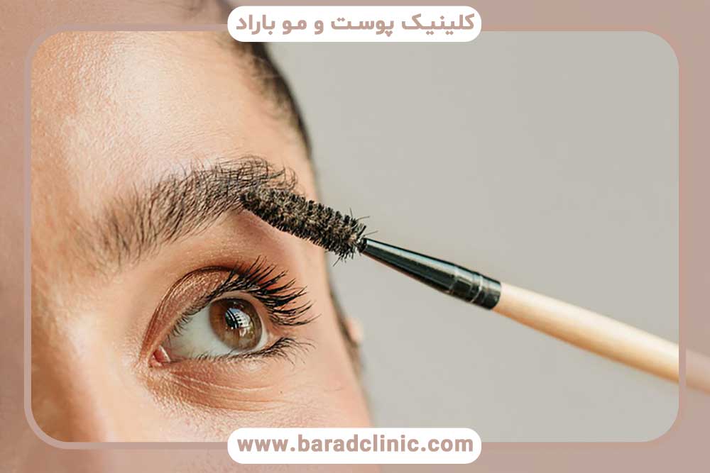 خارش کاشت ابرو