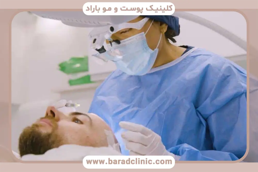 انواع روش‌های کاشت مو 