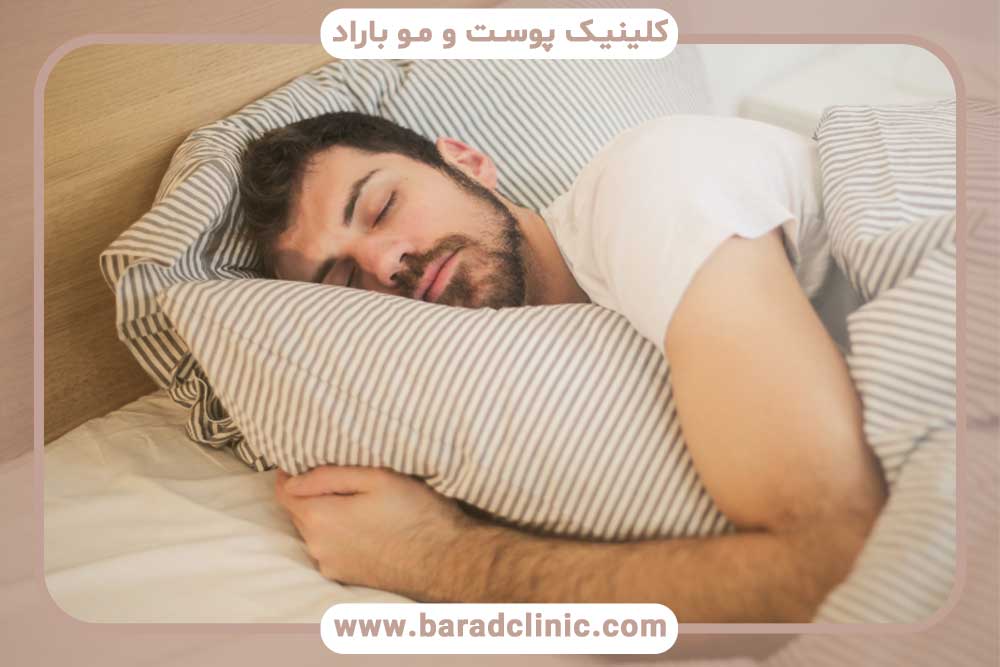 خواب کاشت ابرو