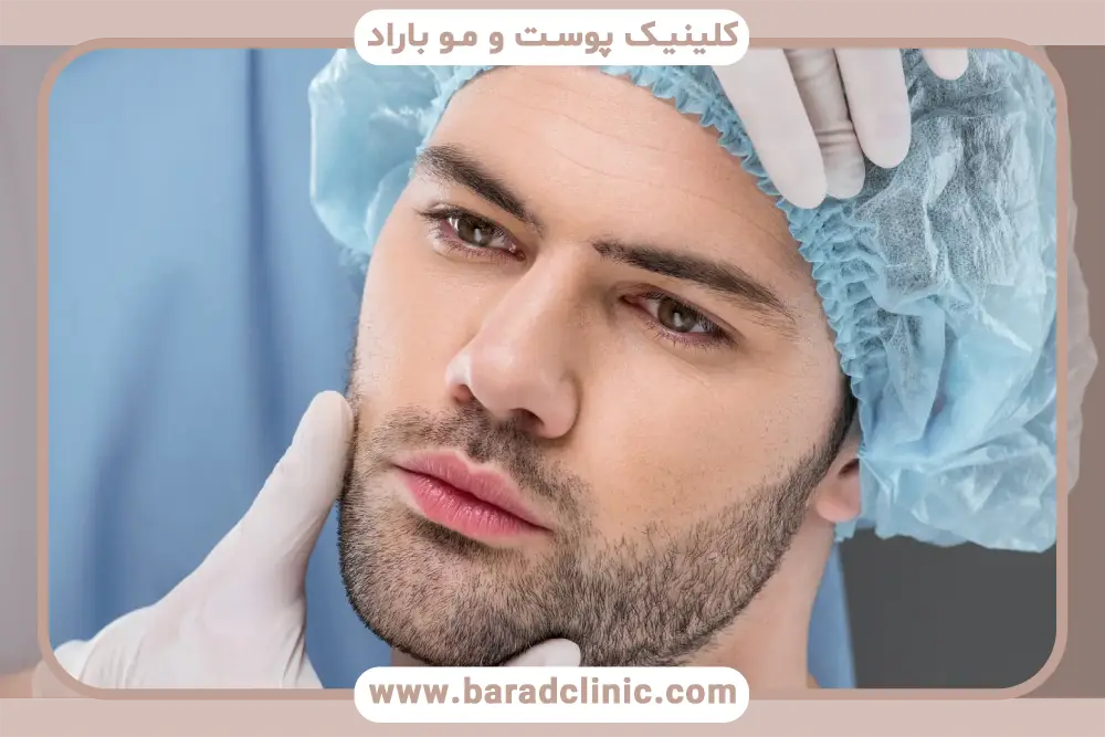 عوامل تاثیرگذار روی هزینه کاشت ریش تهران
