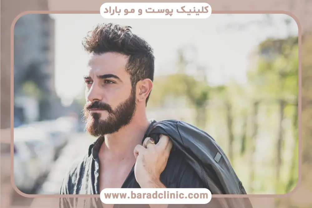 مشاوره اولیه در کاشت ریش طبیعی 