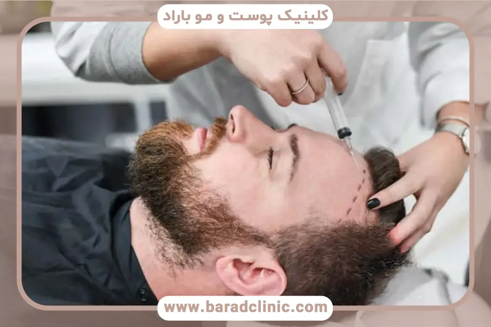 دلیل محاسبه قیمت کاشت هر تار مو 