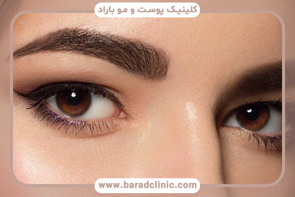 چه کسانی نباید کاشت ابرو انجام دهند