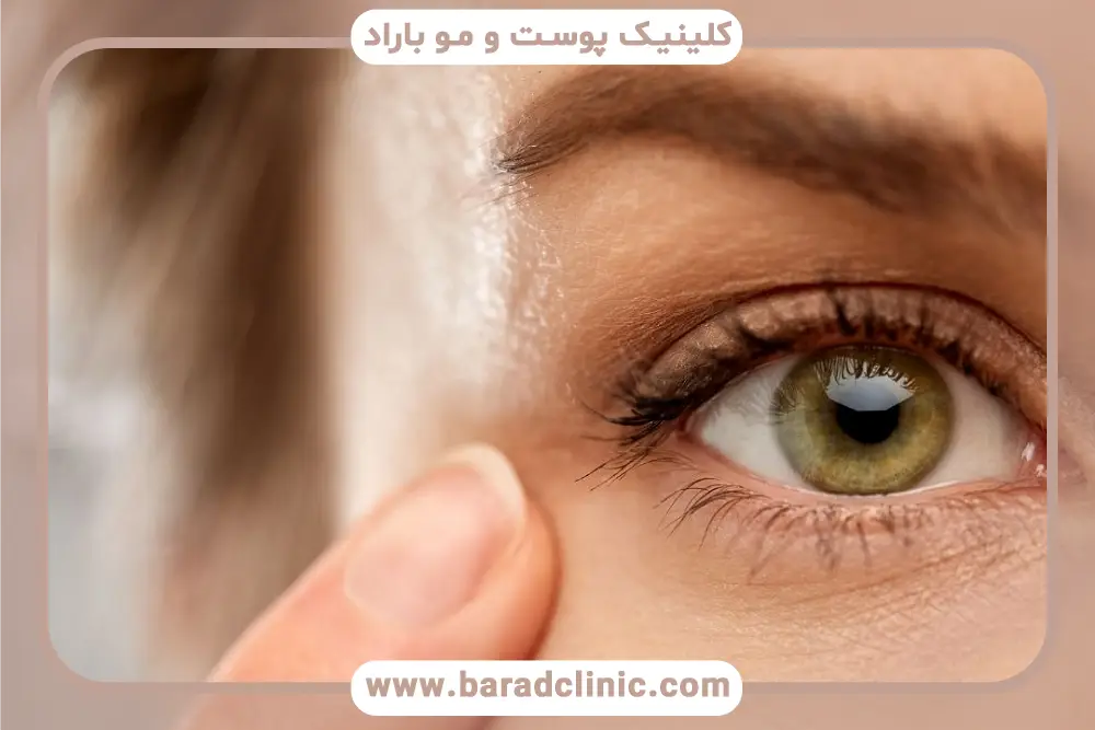 تجربه و سابقه جراح بلفاروپلاستی 