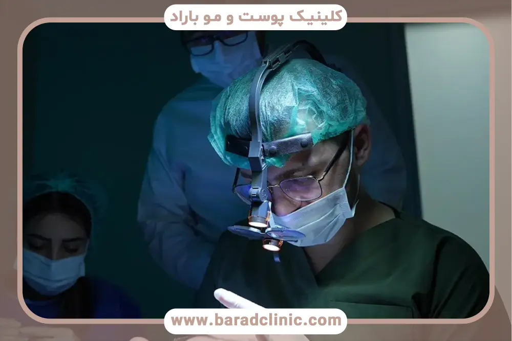 کاشت ریش چند ساعت طول میکشد؟