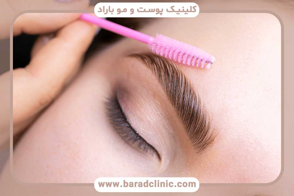 کاشت ابرو طبیعی