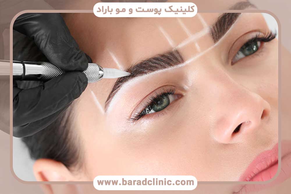 مراحل عمل کاشت ابرو