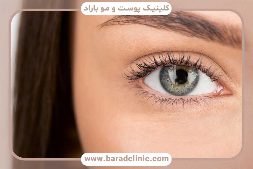 کاشت ابرو بعد از چند ماه طبیعی می‌شود؟