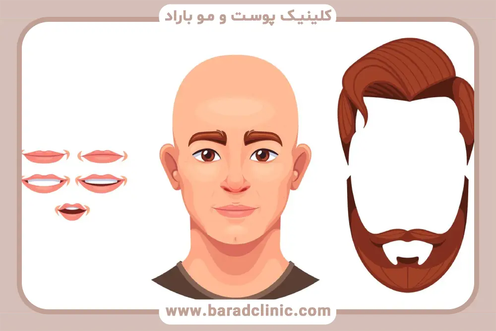 اشتباهات رایج در بررسی کاشت ریش اینستا 