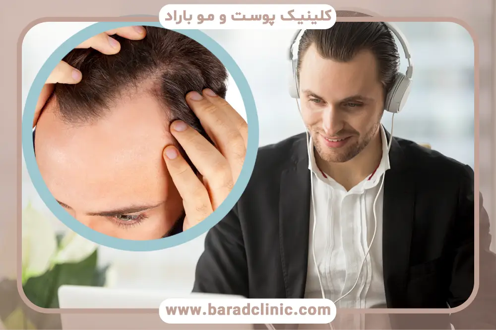 مزایای مشاوره رایگان کاشت مو 