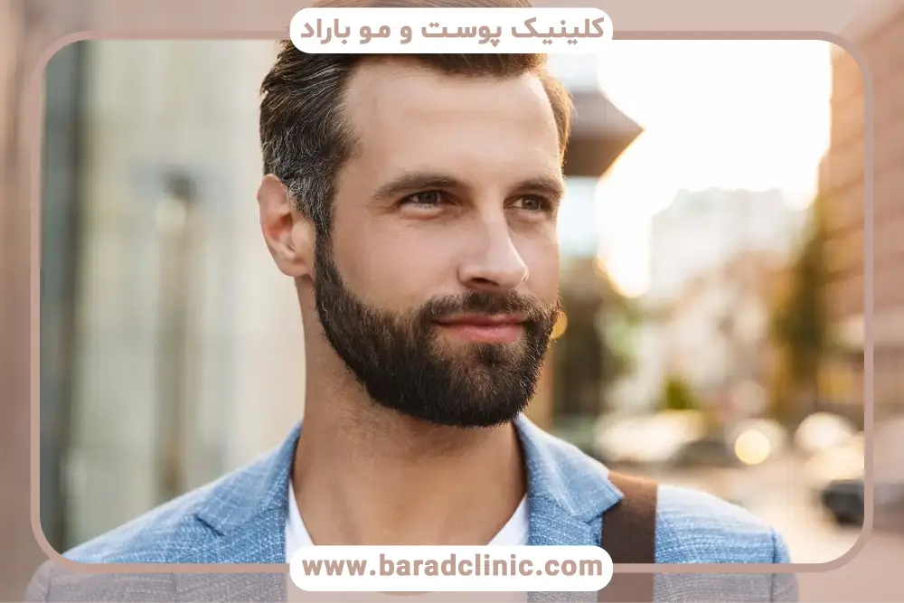 مراحل کاشت ریش بدون جراحی 