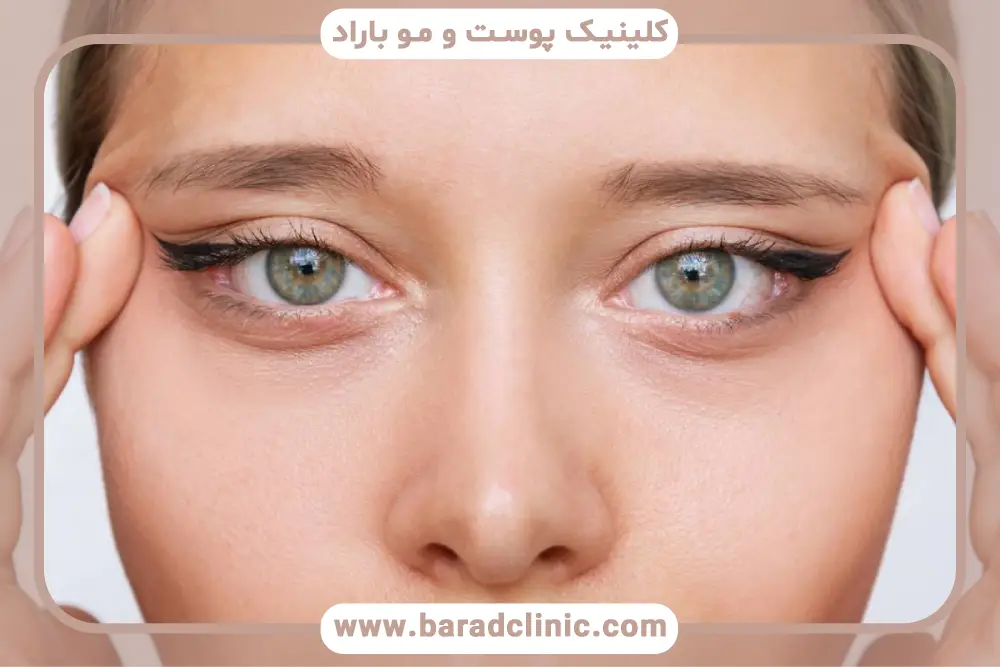 فرق کانتوپلاستی و بلفاروپلاستی در نحوه انجام عمل