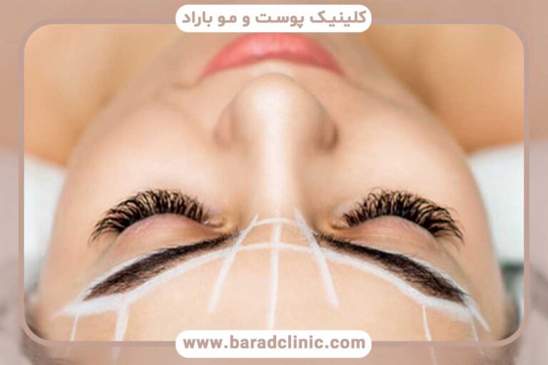 چه کسانی نباید کاشت ابرو انجام دهند