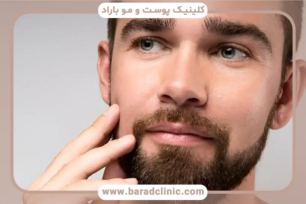 بهترین کلینیک کاشت ریش در جای بخیه