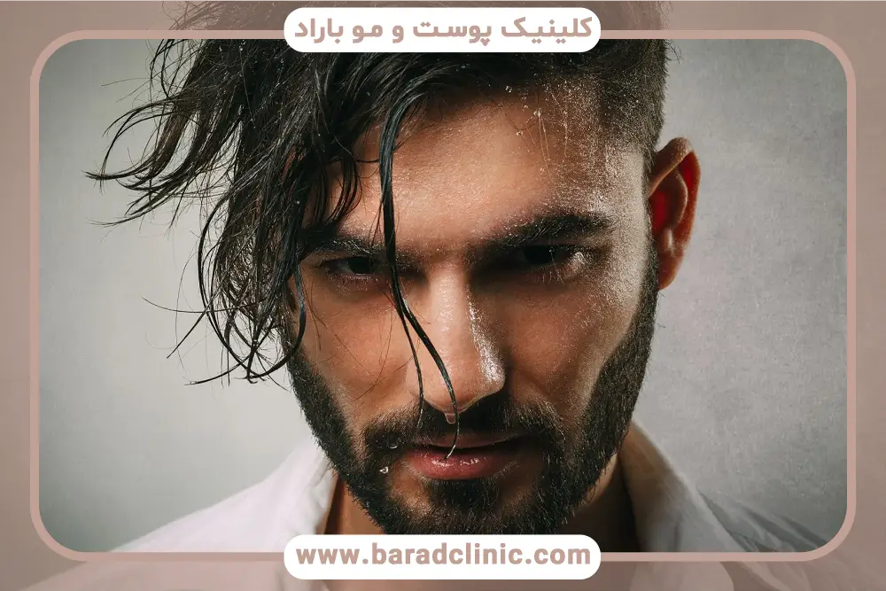 مراحل کاشت ریش در جای زخم 