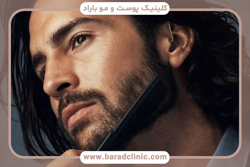 مراحل کاشت ریش طبیعی 