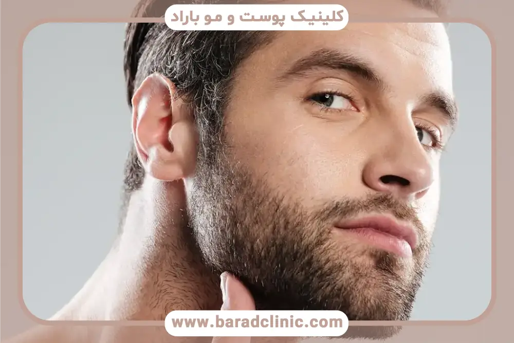 نکات مهم اولین حمام بعد از کاشت ریش 