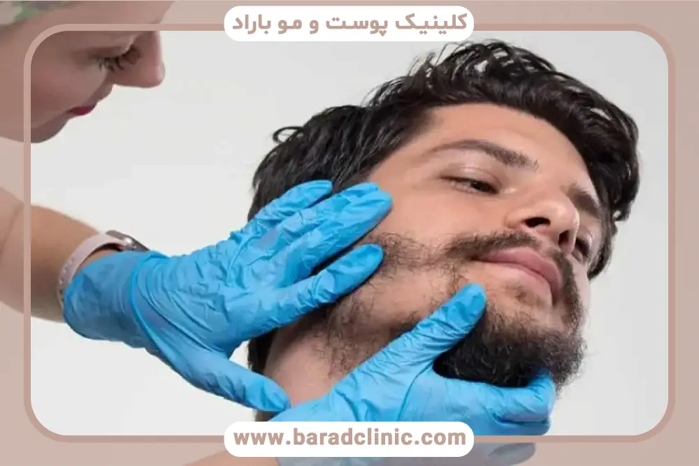 روش‌های کاشت ریش پروفسوری 