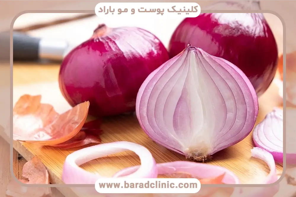 مزایای خوردن پیاز بعد از کاشت مو