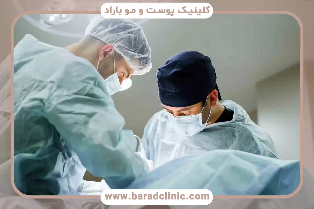 تاثیر مهارت جراح روی زمان کاشت ریش