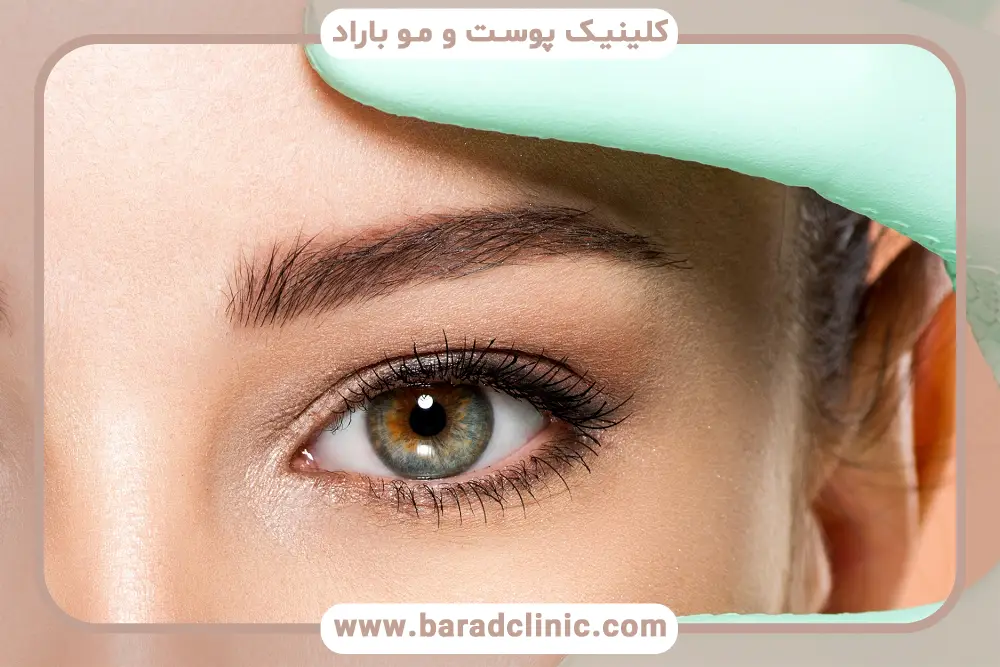 ورزش بعد از بلفاروپلاستی در روز نخست