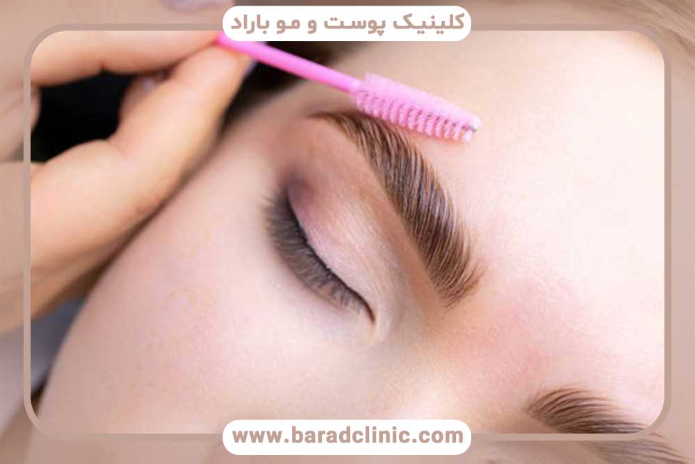 قیچی ابرو بعد از کاشت