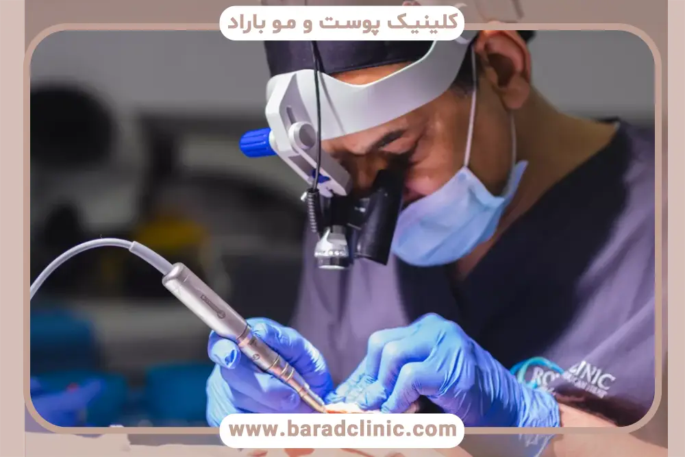 عکس مراحل رشد مو بعد از کاشت در ماه پنجم