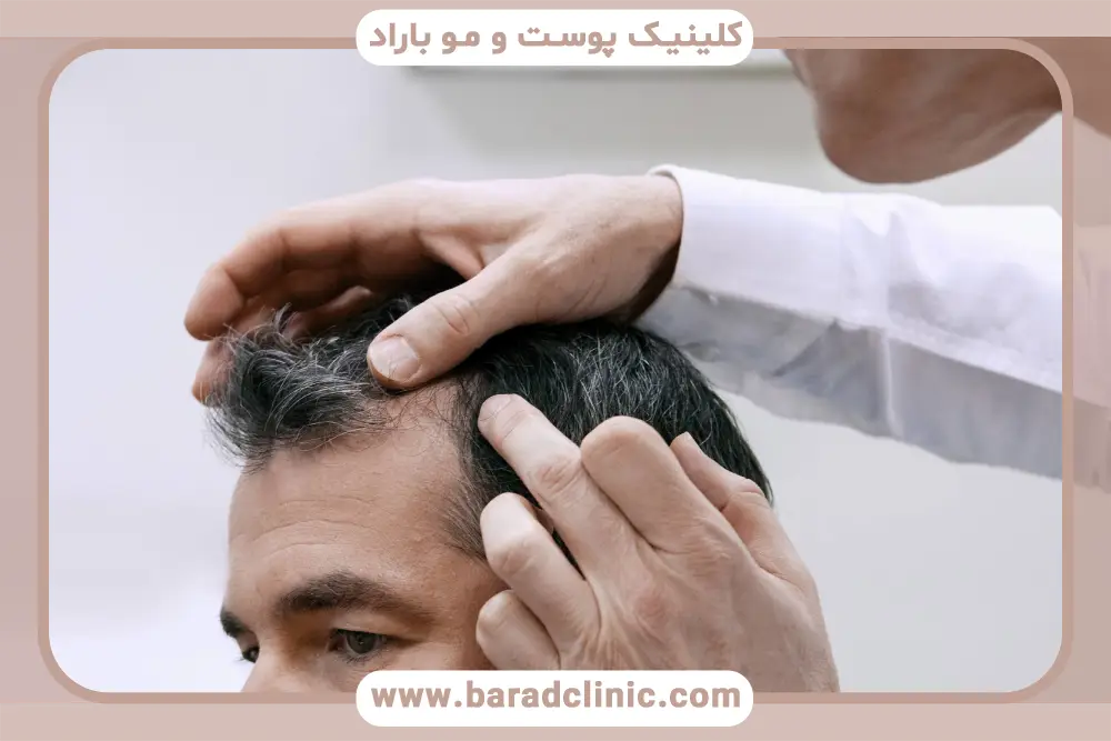 مشاوره رایگان کاشت مو در کلینیک باراد