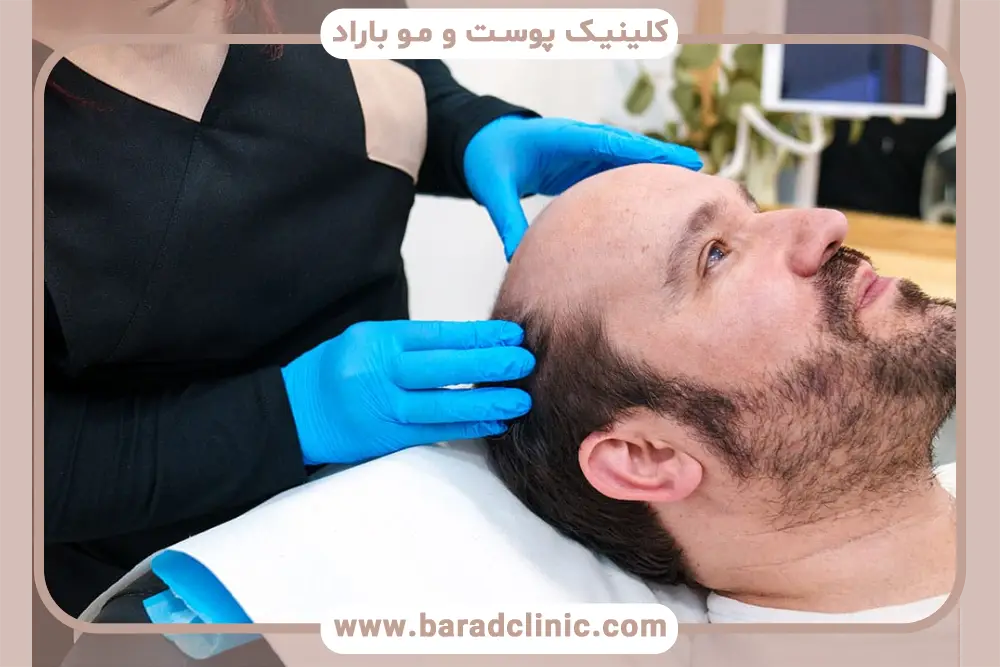 انتخاب بهترین کلینیک کاشت مو
