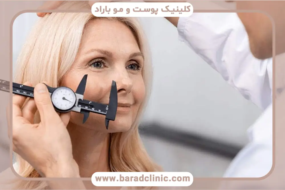 دوره نقاهت بلفاروپلاستی با بی‌حسی یا بیهوشی