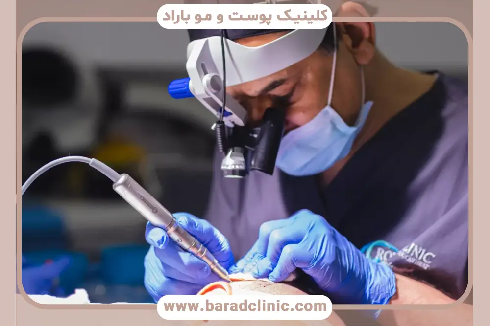 مشاوره قبل از انتخاب بهترین روش کاشت مو در دنیا 