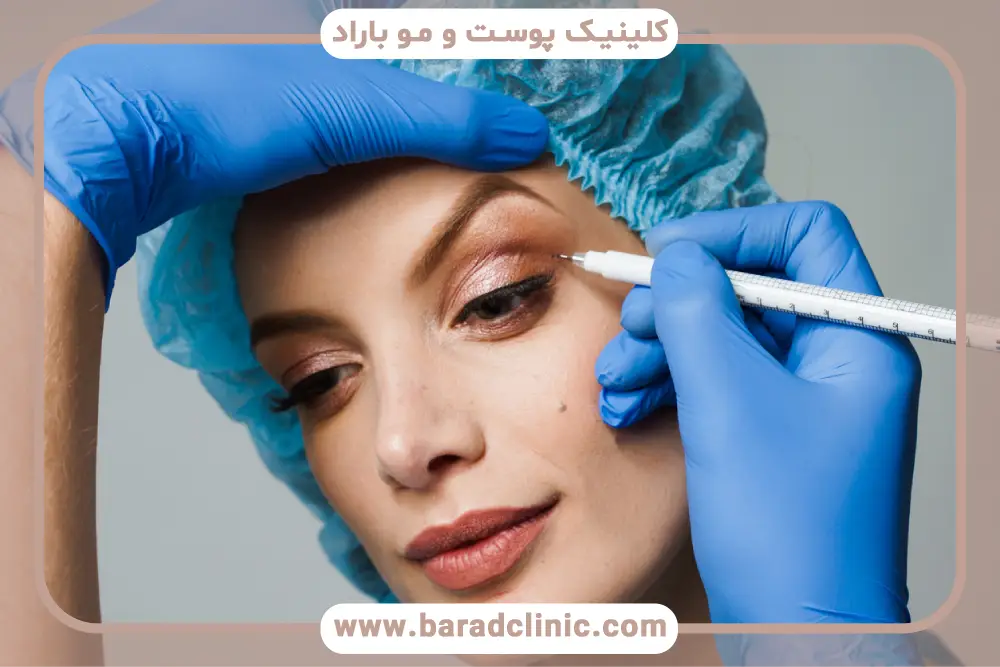 عوامل تاثیرگذار روی هزینه بلفاروپلاستی صورت چیست