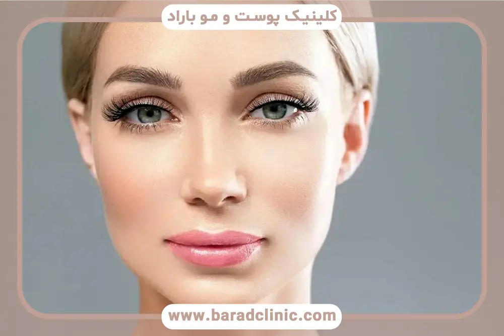 عوارض احتمالی بلفاروپلاستی چشم شرقی 