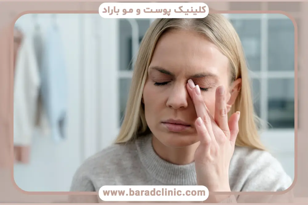 درمان خشکی چشم بعد از بلفاروپلاستی 