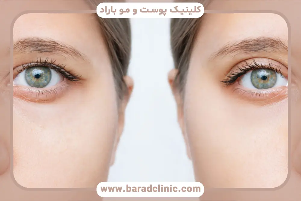 نظرات درباره جراح بلفاروپلاستی 