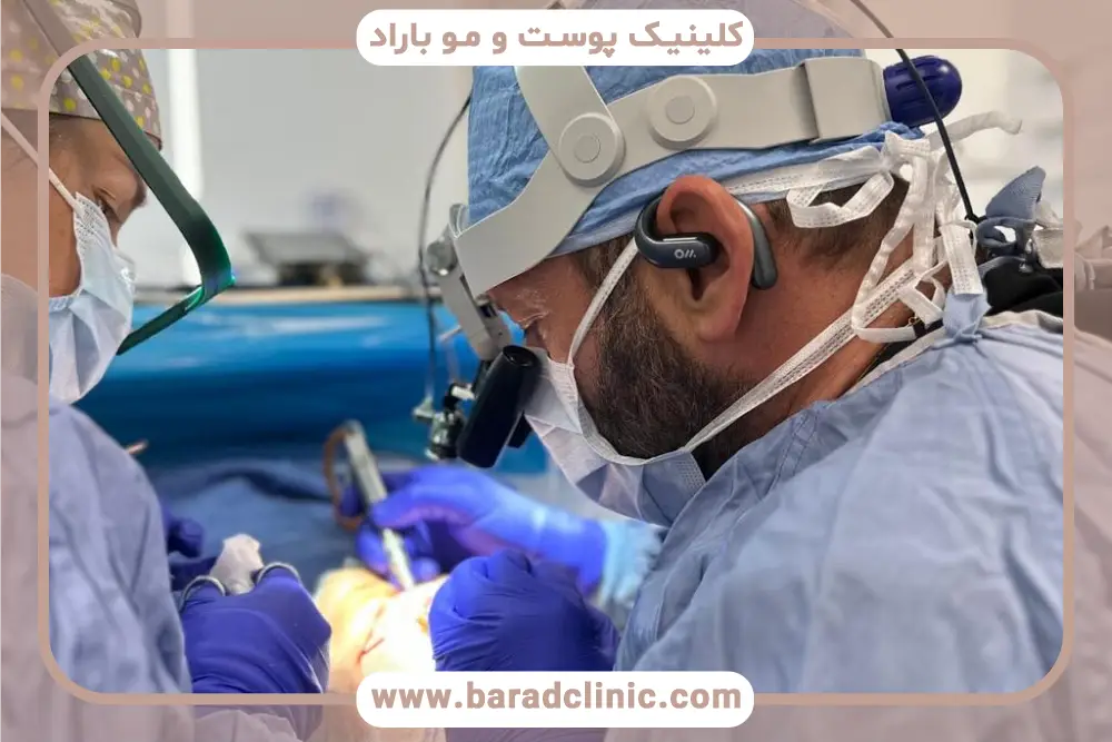 کاشت ریش در یک یا چند جلسه؟ 