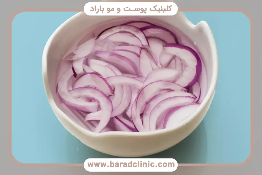 پیاز و ریزش مو 