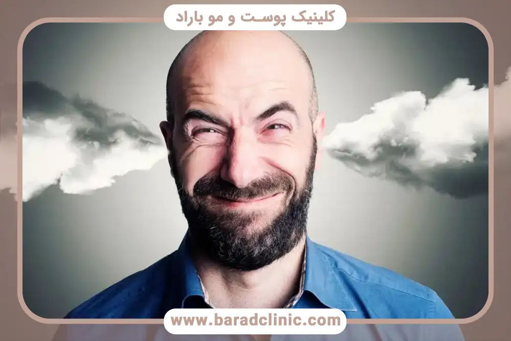تاثیر دخانیات در ریزش مو