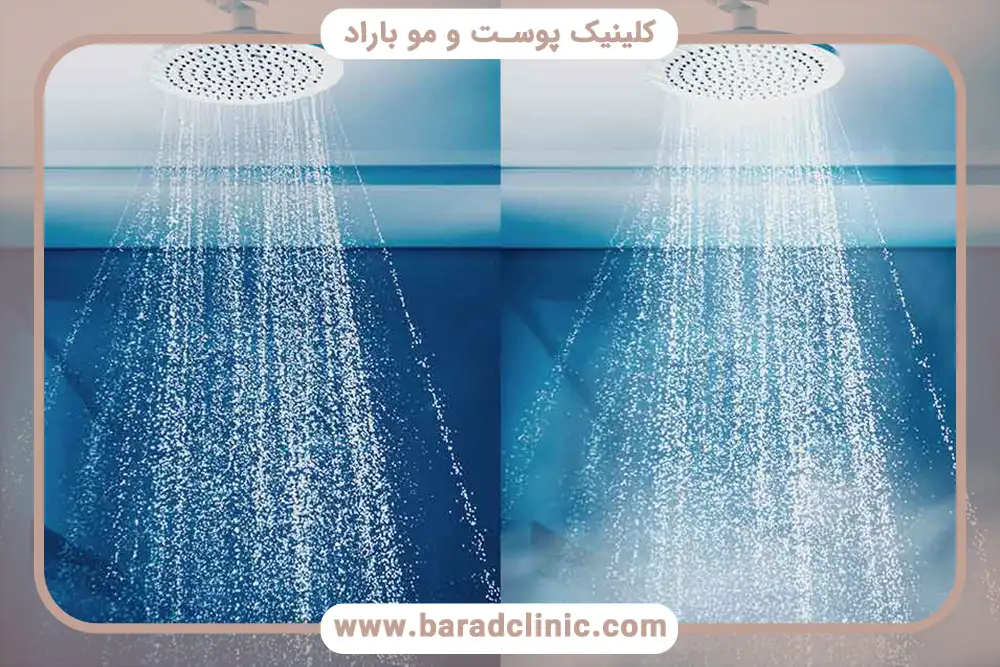 تاثیر حمام اب گرم در ریزش مو