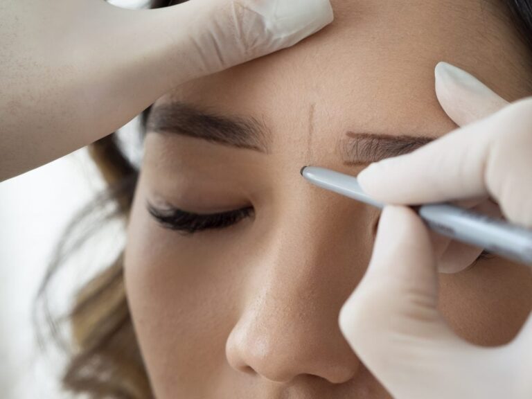 روش کاشت ابرو ترکیبی