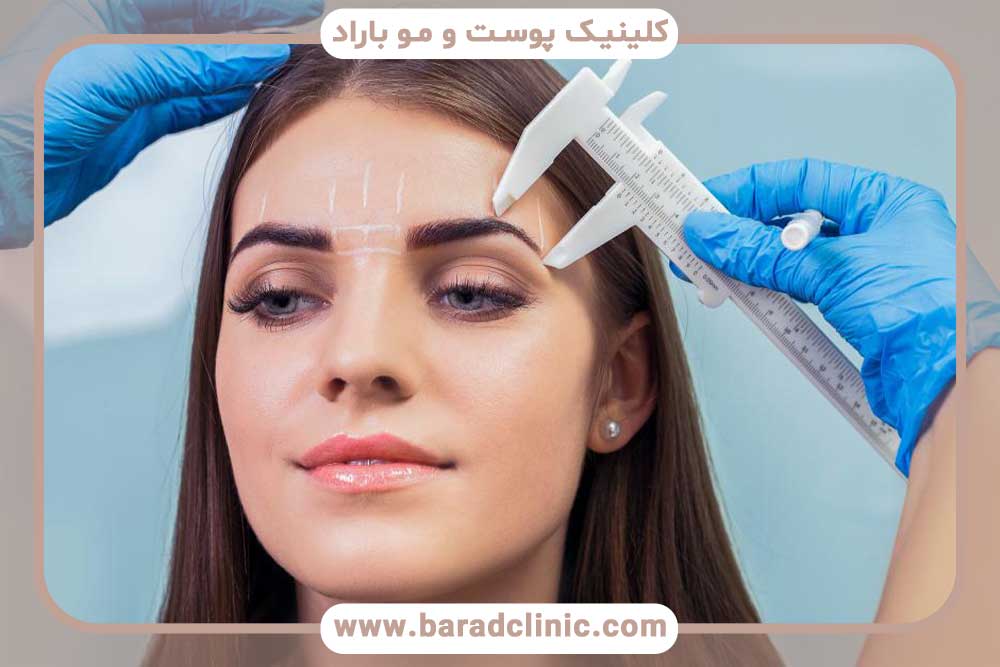 کاشت ابرو اقساطی در تهران