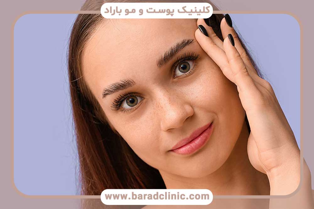 نتیجه کاشت ابرو بعد از سه ماه