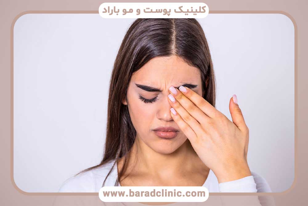 خارش کاشت ابرو