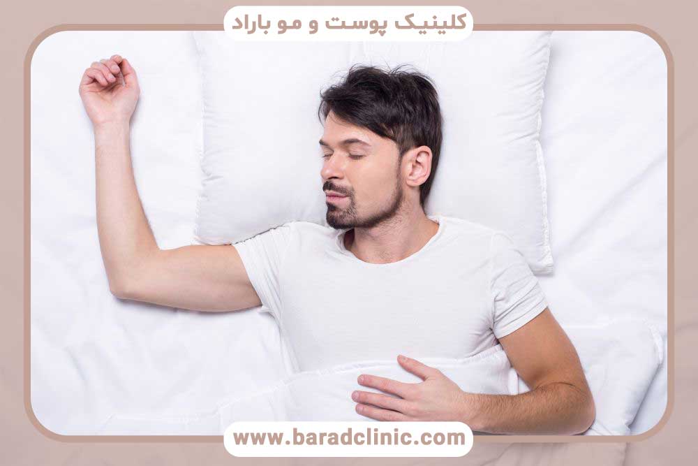 خواب کاشت ابرو