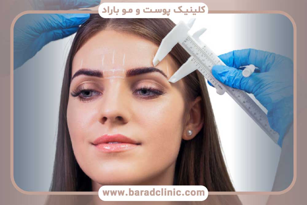 خطرات کاشت ابرو