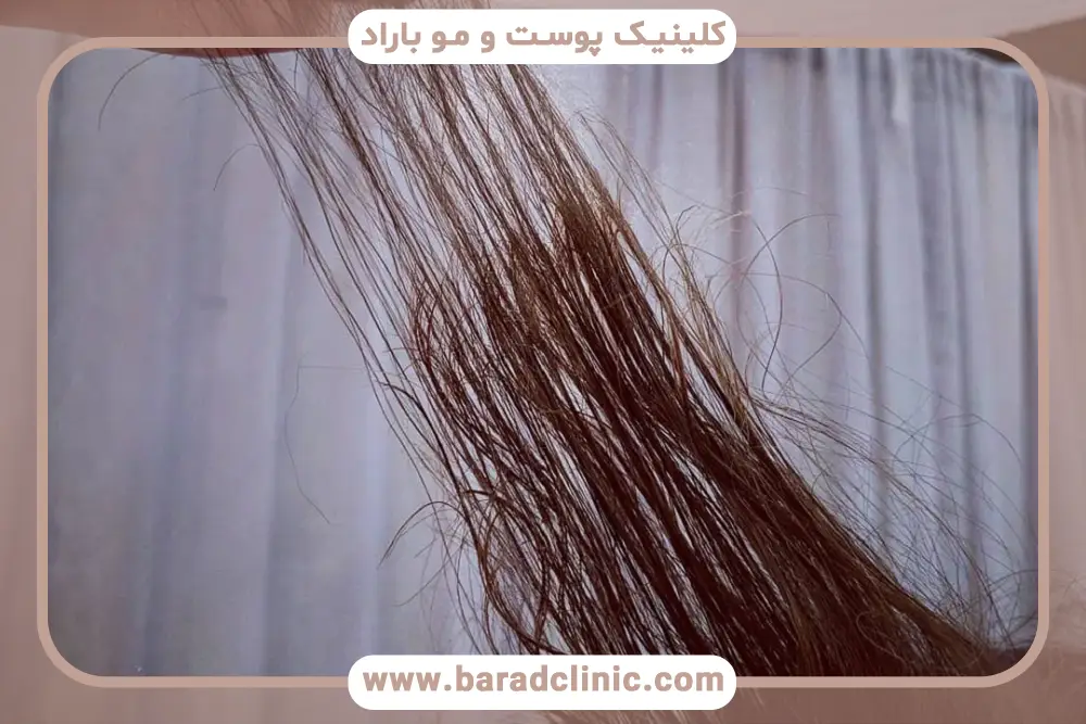 مايكروپوينت مو چیست