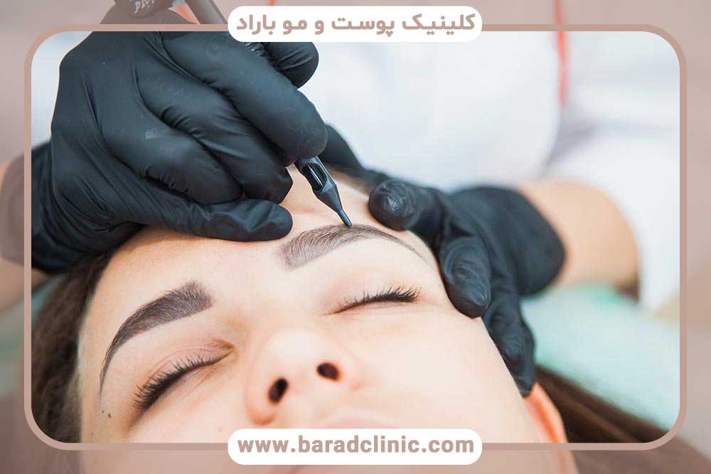 کاشت ابرو روی تاتو