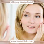 راکوتان و کاشت ابرو