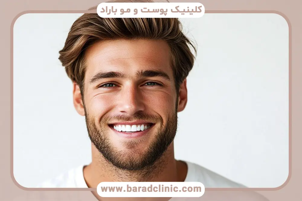 روش fit کاشت مو